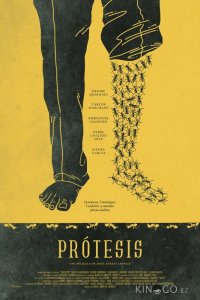 Протез 