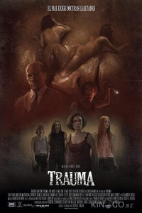Травма 