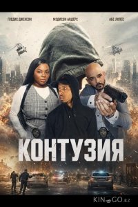 Контузия 